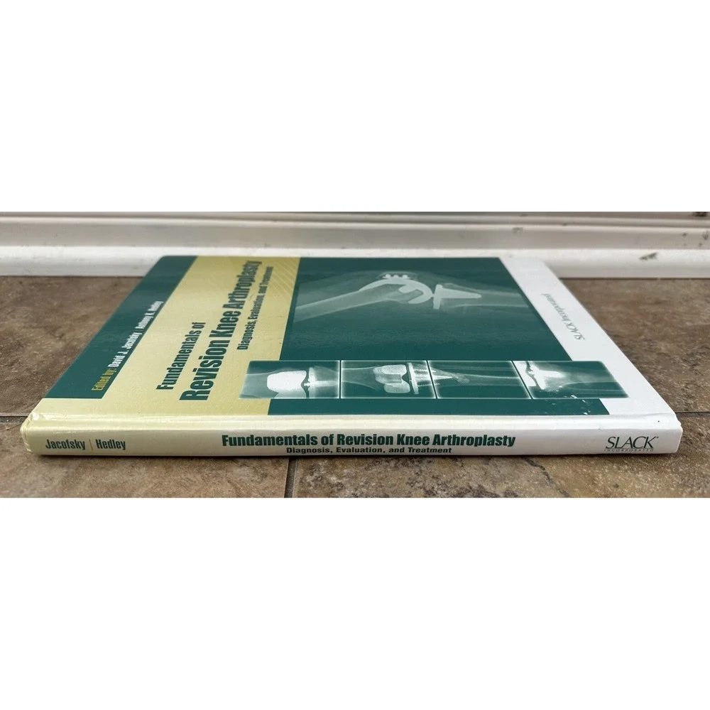 Fundamentals of Revision Knee Arthroplasty : Diagnosis, Evaluation, and Treat...